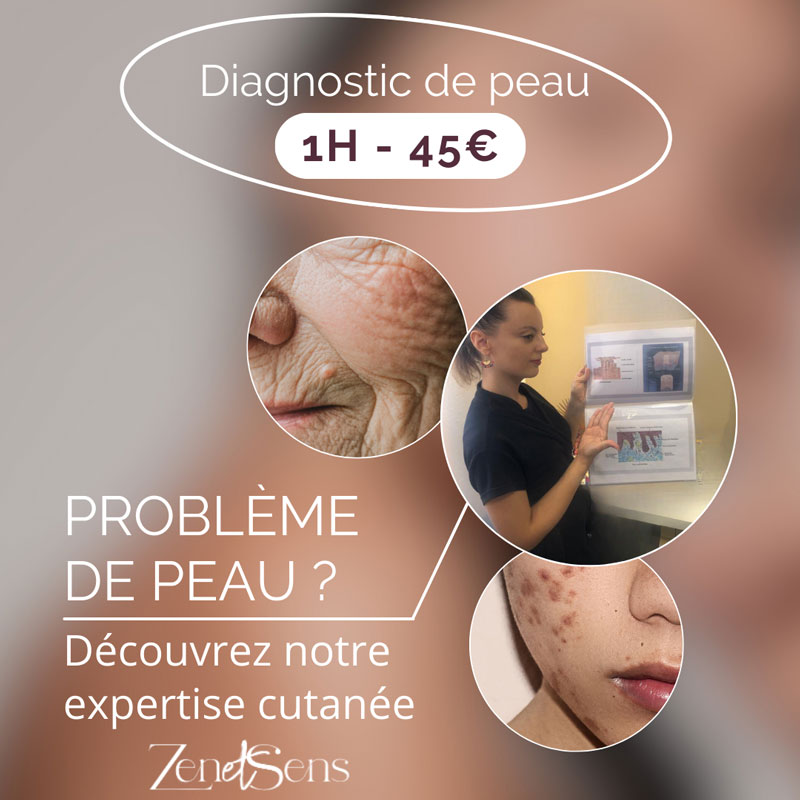 diagnostic-peau-zen-et-sens-institut-toulouse