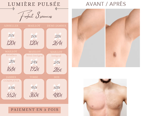 lumiere-pulsee-epilation-toulouse-zen et sens