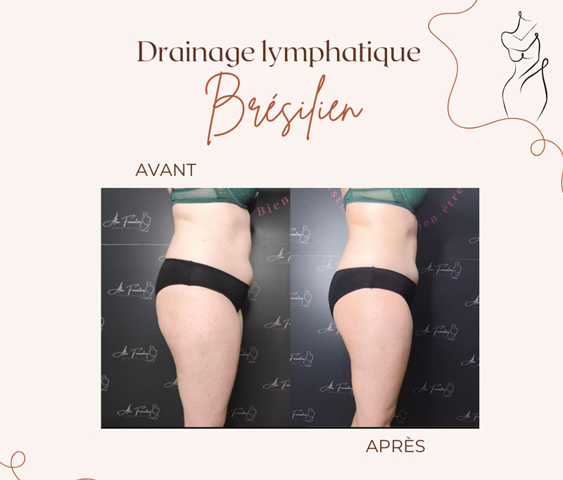 drainage-lymphatique-institut-toulouse-2