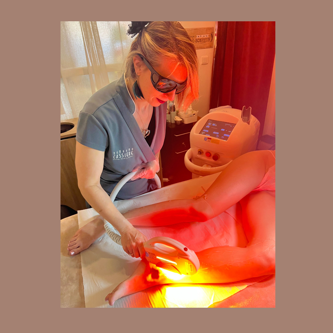 epilation durable toulouse